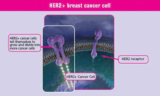 HER2+ breast cancer cell with HER2 receptors